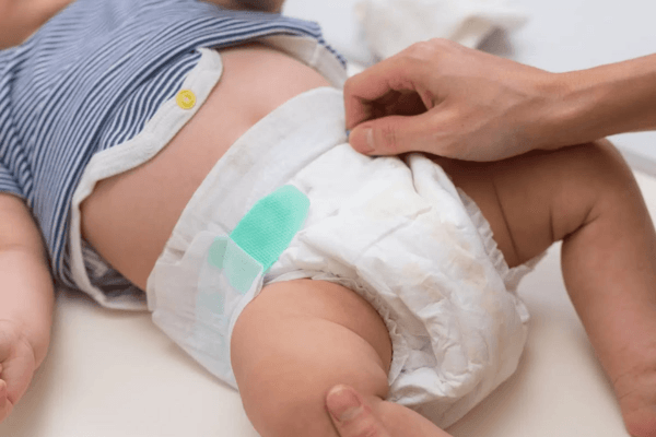 Những Lỗi Thường Gặp Khi Thay Tã Khiến Bé Dễ Bị Hăm Da